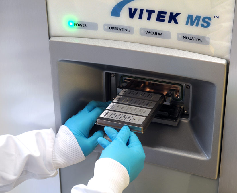 Hệ thống định danh vi khuẩn nhanh bằng nguyên lý khối phổ VITEK MS