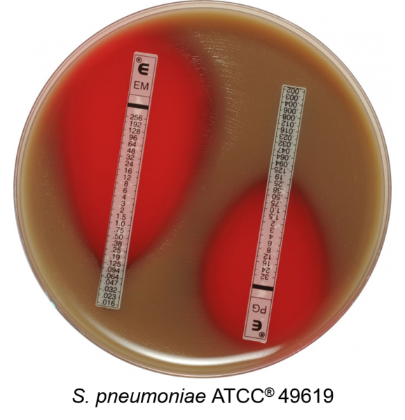 Mueller Hinton Agar + 5% Sheep Blood