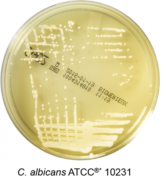 Sabouraud Dextrose Chloramphenicol Agar